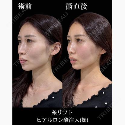 柳 立樹の症例
