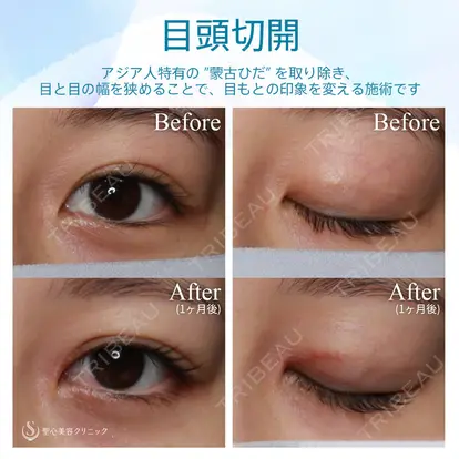 寺町 英明先生の症例