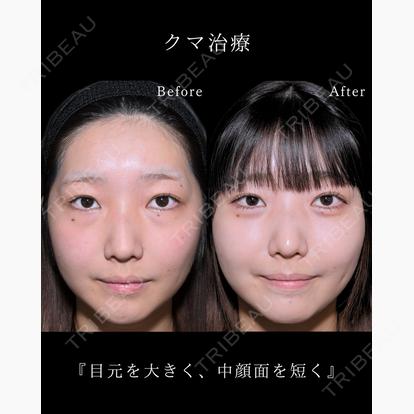 小川 杏平の症例