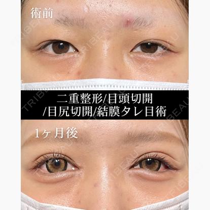 柳 立樹の症例