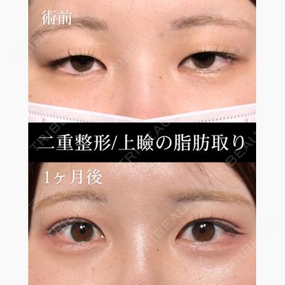 柳 立樹の症例