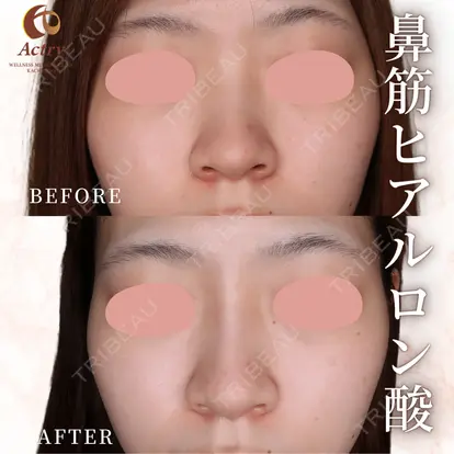 吉見　公一先生の症例