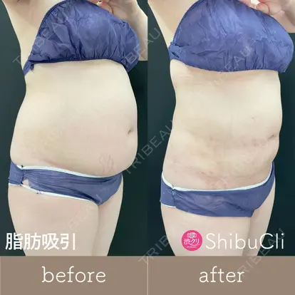 峯岸 季清先生の症例