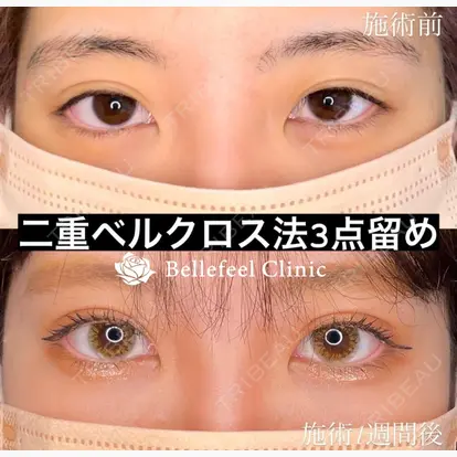 Bellefeel Clinic 代官山の症例