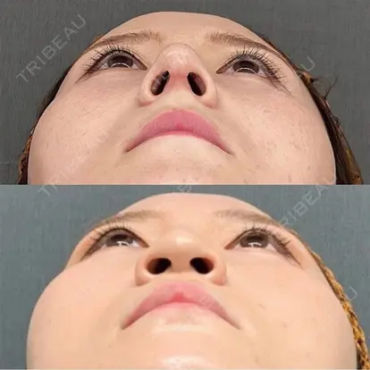 麻生美容外科クリニック 札幌院の症例