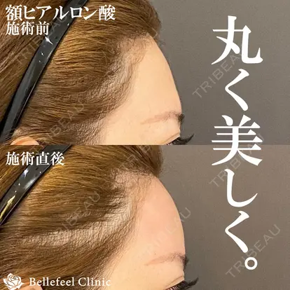 Bellefeel Clinic 代官山の症例