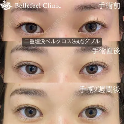 Bellefeel Clinic 代官山の症例