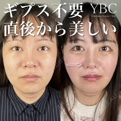YBC横浜美容外科 大宮院の症例