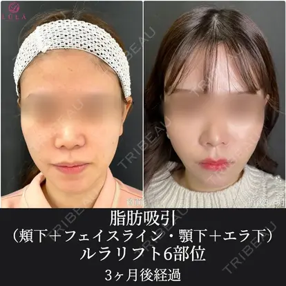 藤川 一朗先生の症例