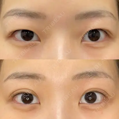 藏薗 侑人先生の症例