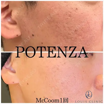 小松 塁先生の症例