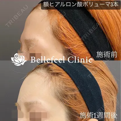 Bellefeel Clinic 代官山の症例