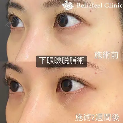 Bellefeel Clinic 代官山の症例