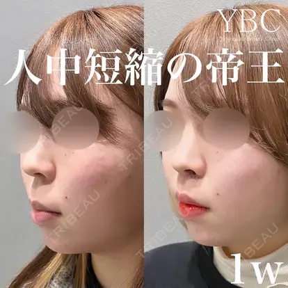 YBC横浜美容外科 大宮院の症例