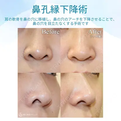 伊藤 康平先生の症例