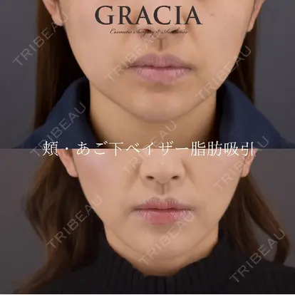 GRACIA clinic 【グラシアクリニック】の症例