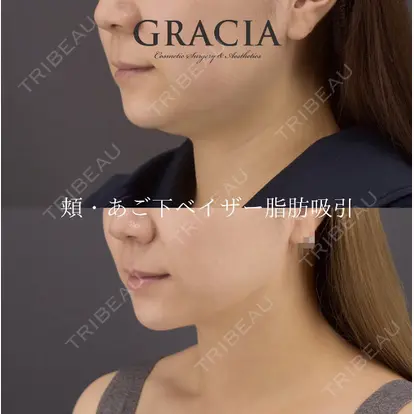 GRACIA clinic 【グラシアクリニック】の症例