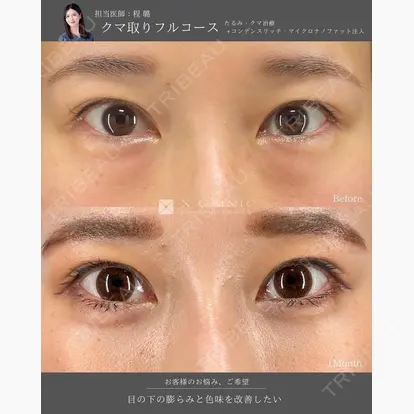 程 璐先生の症例