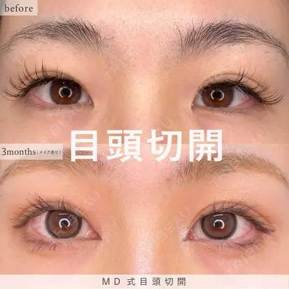 吉原 伯先生の症例