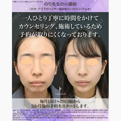 伊藤賀敏先生の症例