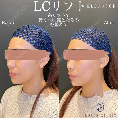 小松 塁先生の症例