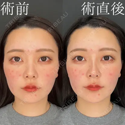 柏木 太雅先生の症例