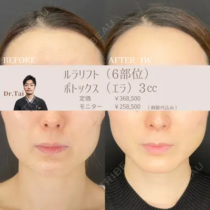 山本 泰輔先生の症例