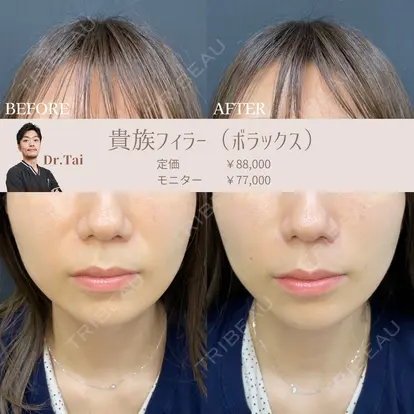 山本 泰輔先生の症例