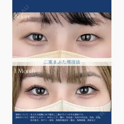 AI Beauty Clinic （エーアイ美容クリニック）の症例