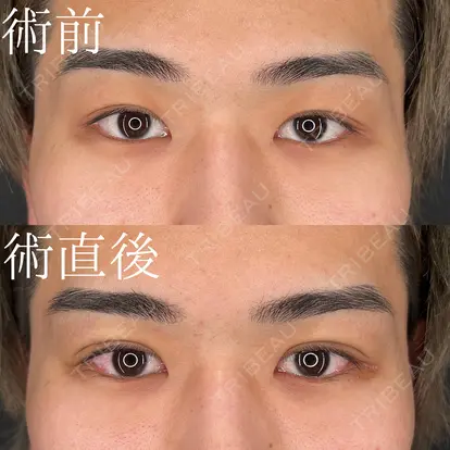 柏木 太雅先生の症例