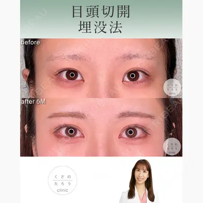 立雅恵先生の症例