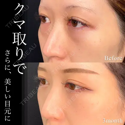 小出 真哉 ※現在指名不可先生の症例