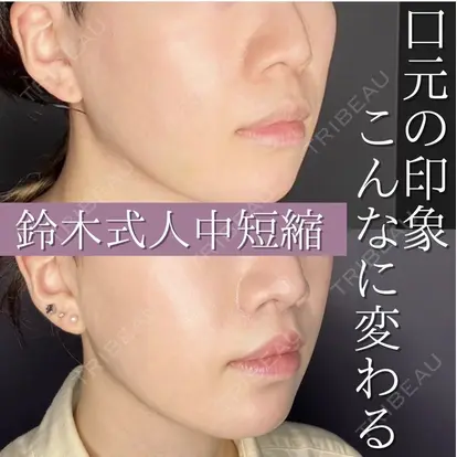 鈴木 彩馨先生の症例