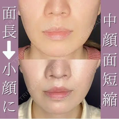 鈴木 彩馨先生の症例