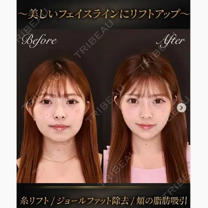 森 光先生の症例