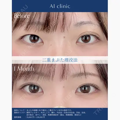 AI Beauty Clinic （エーアイ美容クリニック）の症例