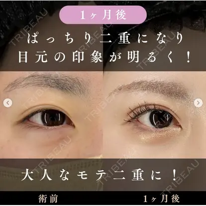 北尾 善杜先生の症例