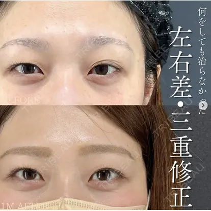 北尾 善杜先生の症例