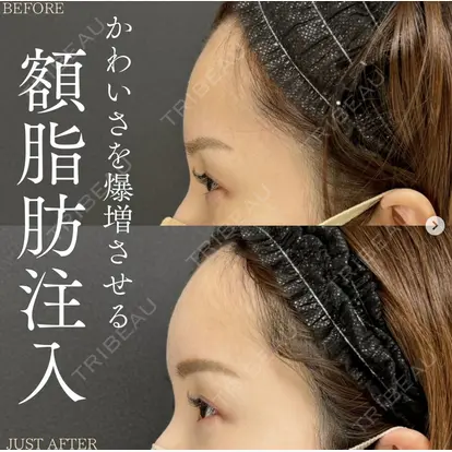 北尾 善杜先生の症例