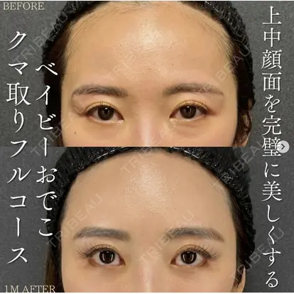 北尾 善杜先生の症例