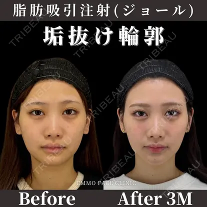 木之下 哲彦先生の症例