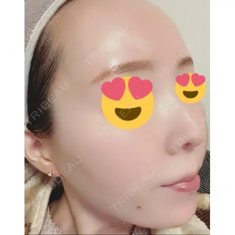 ルメッカ 豊洲内科・糖尿病 / 形成・美容外科クリニック AFTER