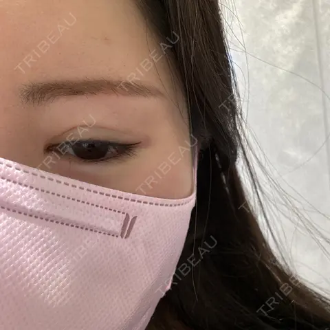 アートメイク（アイライン） Tokyo Tensei Clinic 銀座院 DAY 0