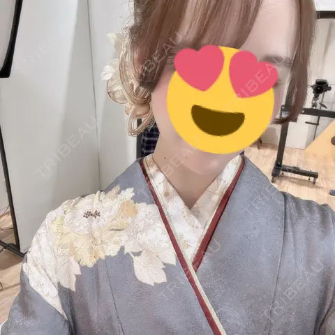 糸リフト / 脂肪吸引（顔） シェリークリニック 新宿本院 AFTER
