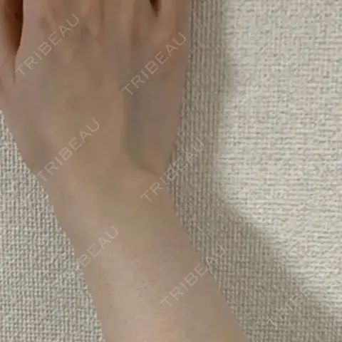 白玉点滴・注射 新宿美容内科医療クリニック AFTER