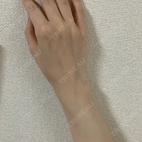 白玉点滴・注射 新宿美容内科医療クリニック AFTER