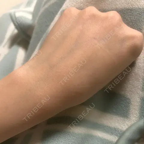 白玉点滴・注射 APOLLO BEAUTY CLINIC AFTER