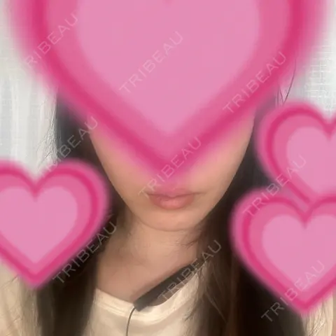 切開リフト / ヒアルロン酸注入（唇） 石倉クリニック 水戸院 AFTER