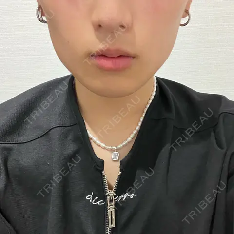 ボトックス（エラ・小顔） R Beauty CLINIC 名古屋院 AFTER