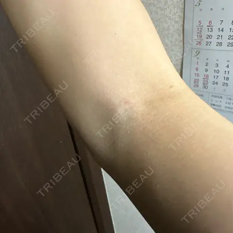 美容点滴・美容注射（美肌） / 白玉点滴・注射 新宿美容内科医療クリニック DAY 0